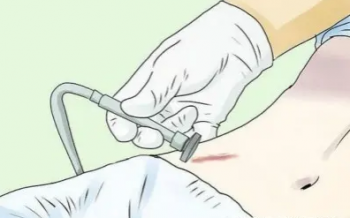 �̺�����ȥ�ĸ�ҽԺ�ȽϺ�